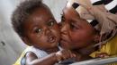 Measles in DR Congo: By air, boat and foot to deliver the vaccine